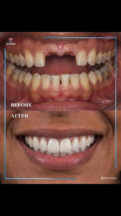 Dr. Qiu dental implant case 3
