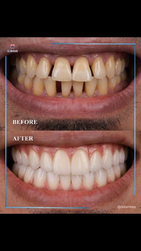 Dr. Qiu dental implant case 4