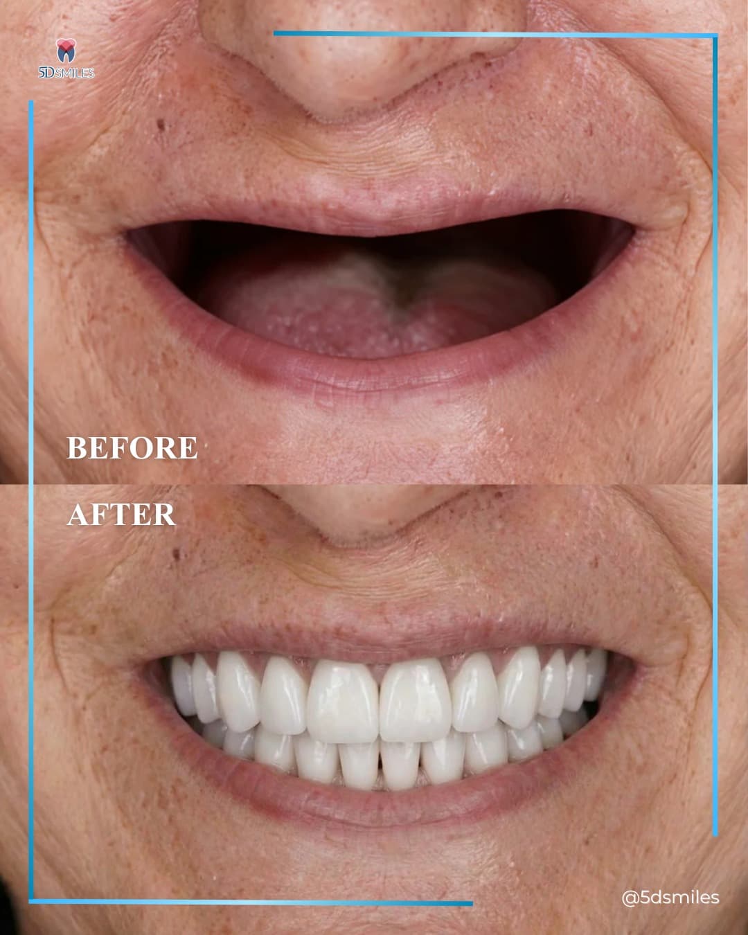 Dr. Qiu dental implant case 6