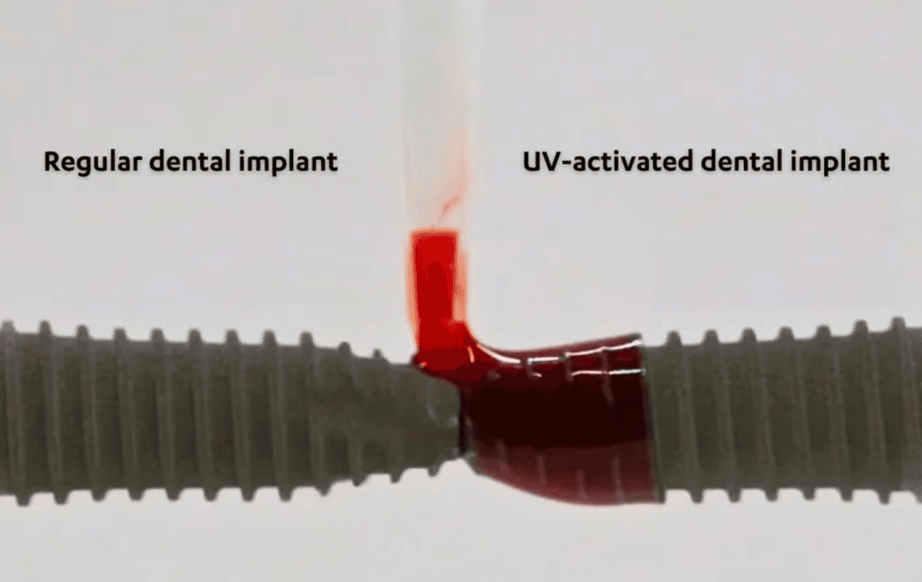 Side-by-side comparison: a regular dental implant repels blood while a UCLA UV-activated implant draws blood across its surface — visual proof of photofunctionalization